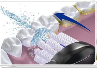 Waterpik Sonic-Fusion 2.0 Professional Flossing Toothbrush(SF-04)