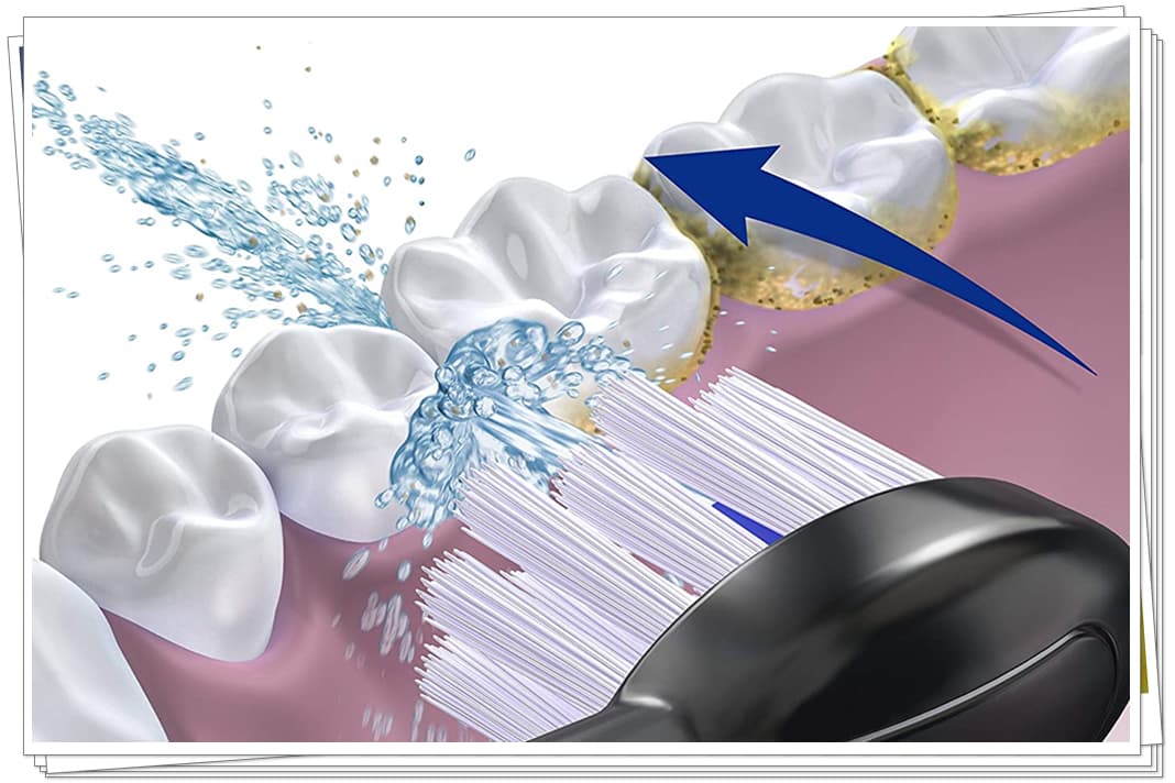 Why Is Waterpik Sonic-Fusion 2.0 (Sf-04) The Best Device For Flossing And Brushing?